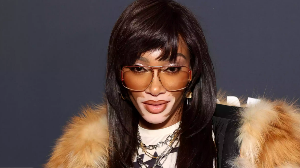 Winnie Harlow Sets Super Bowl 2024 on Fire Wearing Bottega Veneta