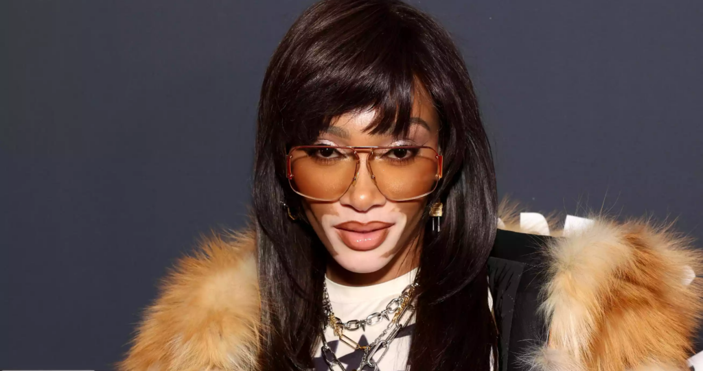 Winnie Harlow Sets Super Bowl 2024 on Fire Wearing Bottega Veneta